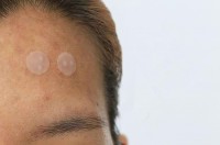 acne-patch-solusi-untuk-membasmi-jerawat.jpg